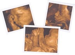Ultrasound Services - 4D Sonography - Albany OB-GYN - Albany, GA